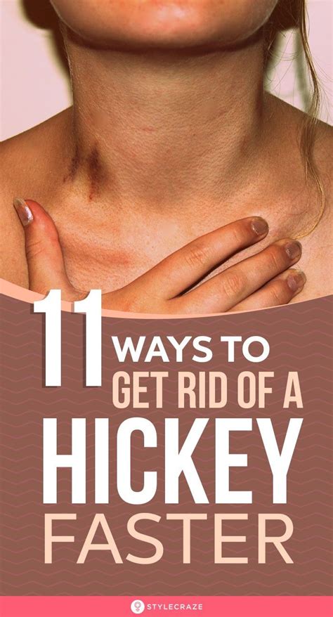 Master the Art: How to Fake a Hickey